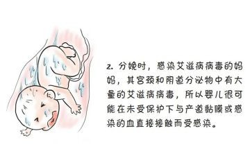 预防艾滋病活动方案5篇
